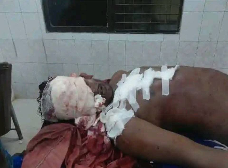 মধুপুরে ভয়াবহ বাস-ট্রাক সংঘর্ষে নিহত ৭, আহত বহু; মাদারগঞ্জগামী বাসে ছিল অধিকাংশ যাত্রী